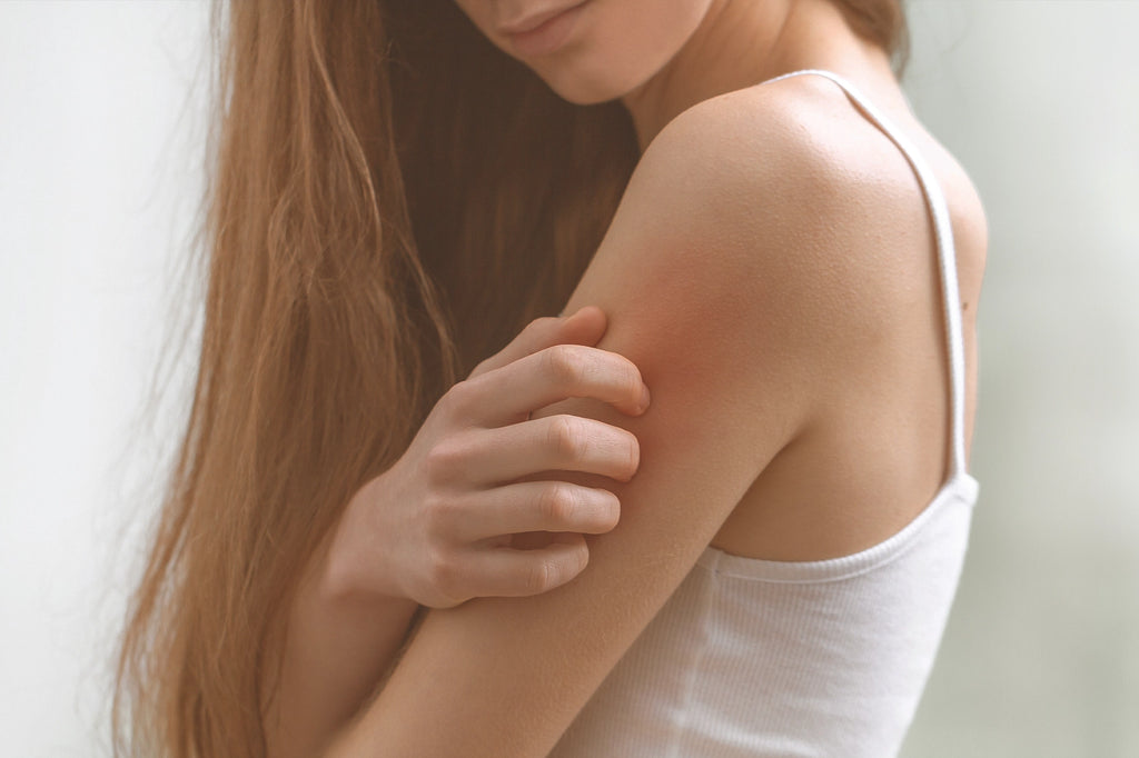 Schuppenflechte (Psoriasis): Entdecke Deine Pflegeroutine!